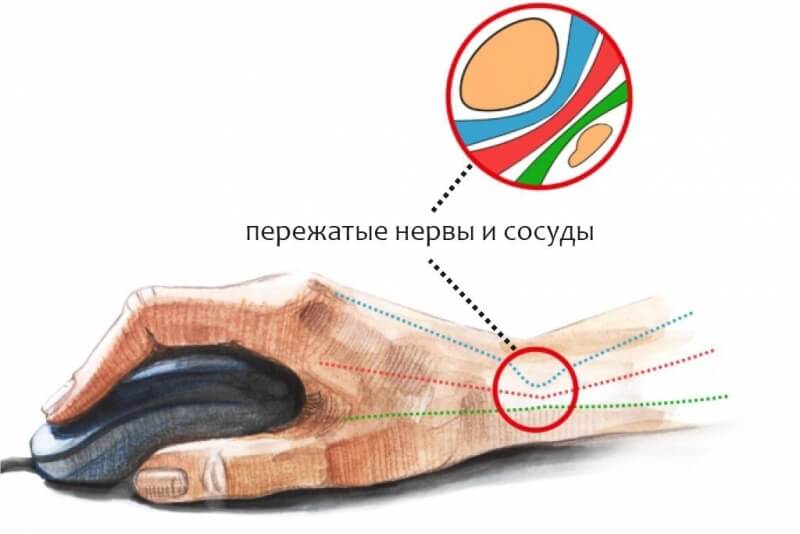 Что такое кракен наркотик